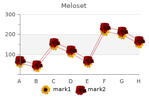 order 3mg meloset with mastercard