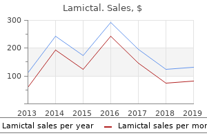 cheap 100mg lamictal overnight delivery