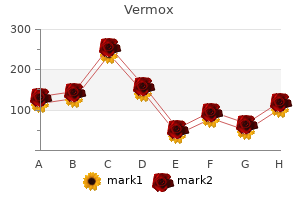 buy 100 mg vermox otc