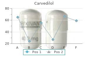 buy carvedilol uk