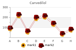 cheap carvedilol online master card