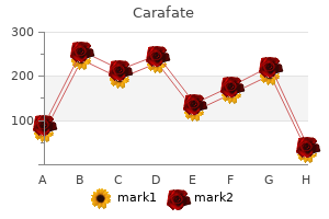 cheap carafate express