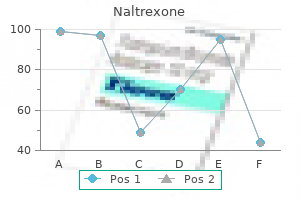 buy naltrexone 50 mg amex