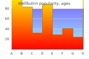 cheap wellbutrin 300 mg amex