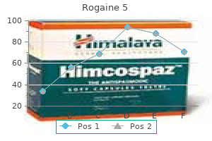 discount rogaine 5 60 ml fast delivery