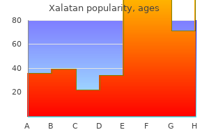 2.5 ml xalatan sale