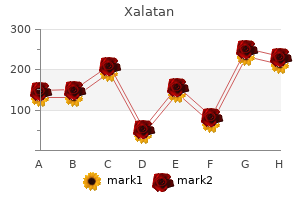 order xalatan 2.5  ml amex