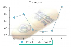 buy 200mg copegus with amex