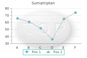 purchase sumatriptan online pills