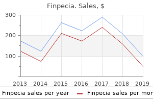 buy cheap finpecia 1mg on line